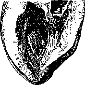 Hypertrophy: figure 2 from the 1928–1936 encyclopedia article