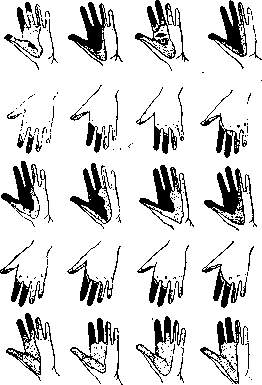 Median Nerve: figure 3 from the 1928–1936 encyclopedia article