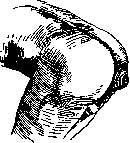 Rectal Prolapse: figure 3 from the 1928–1936 encyclopedia article