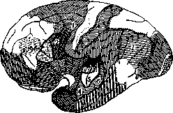 Aphasia: figure 1 from the 1928–1936 encyclopedia article