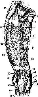 Kyphosis (or roundback, see): figure 5 from the 1928–1936 encyclopedia article