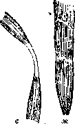 Kyphosis (or roundback, see): figure 2 from the 1928–1936 encyclopedia article