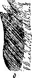 Kyphosis (or roundback, see): figure 1 from the 1928–1936 encyclopedia article