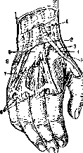 Kyphosis (or roundback, see): figure 4 from the 1928–1936 encyclopedia article