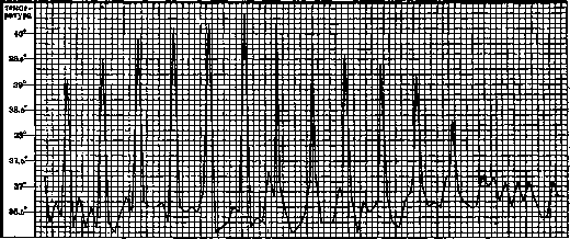 Malaria: figure 20 from the 1928–1936 encyclopedia article