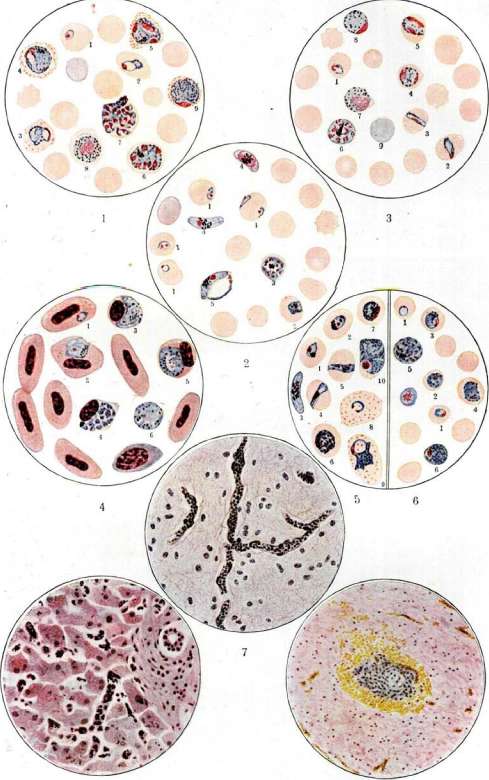 Malaria: figure 2 from the 1928–1936 encyclopedia article