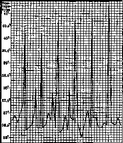 Malaria: figure 21 from the 1928–1936 encyclopedia article