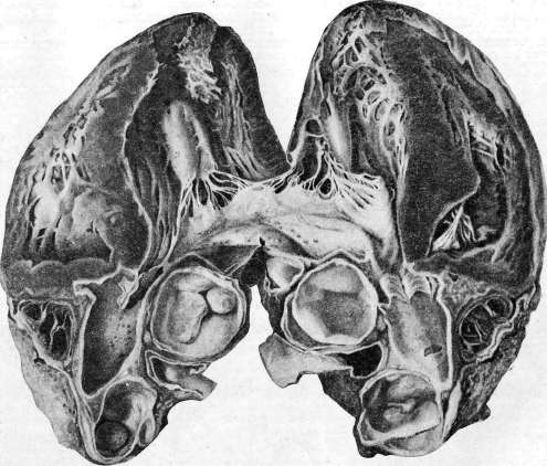 Heart: figure 31 from the 1928–1936 encyclopedia article