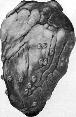 Heart: figure 30 from the 1928–1936 encyclopedia article