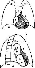 Heart: figure 23 from the 1928–1936 encyclopedia article