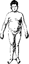 OBESITY: figure 1 from the 1928–1936 encyclopedia article