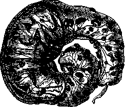 Pregnancy: figure 1 from the 1928–1936 encyclopedia article