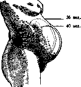 Pregnancy: figure 7 from the 1928–1936 encyclopedia article