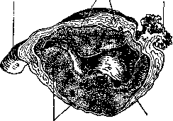 Pregnancy: figure 17 from the 1928–1936 encyclopedia article