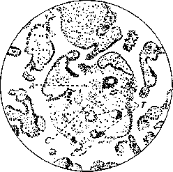 Pregnancy: figure 9 from the 1928–1936 encyclopedia article