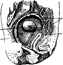 Pregnancy: figure 19 from the 1928–1936 encyclopedia article