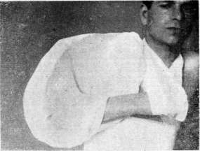 Burns: figure 3 from the 1928–1936 encyclopedia article