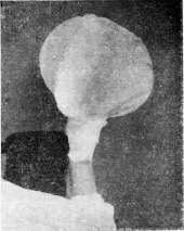 Burns: figure 2 from the 1928–1936 encyclopedia article