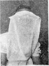 Burns: figure 5 from the 1928–1936 encyclopedia article