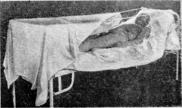 Burns: figure 4 from the 1928–1936 encyclopedia article
