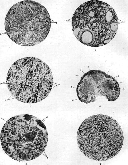 Hans Eppinger: figure 1 from the 1928–1936 encyclopedia article