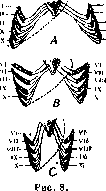 SPLANCHNOMEGALY: figure 6 from the 1928–1936 encyclopedia article