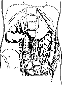 SPLANCHNOMEGALY: figure 4 from the 1928–1936 encyclopedia article