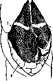 SPLANCHNOMEGALY: figure 7 from the 1928–1936 encyclopedia article