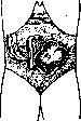 SPLANCHNOMEGALY: figure 3 from the 1928–1936 encyclopedia article