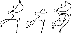INTESTINE: figure 4 from the 1928–1936 encyclopedia article