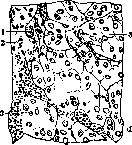 Adrenal Glands: figure 15 from the 1928–1936 encyclopedia article