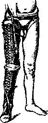 Hessing Apparatus: figure 2 from the 1928–1936 encyclopedia article