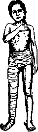 Hessing Apparatus: figure 1 from the 1928–1936 encyclopedia article