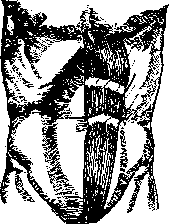 Splenectomy: figure 1 from the 1928–1936 encyclopedia article