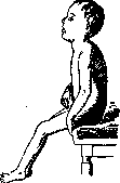 Childhood Paralysis: figure 3 from the 1928–1936 encyclopedia article