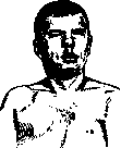 Childhood Paralysis: figure 8 from the 1928–1936 encyclopedia article
