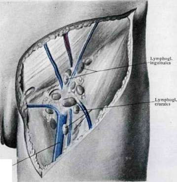 Femoral Canal: figure 5 from the 1928–1936 encyclopedia article