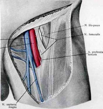 Femoral Canal: figure 6 from the 1928–1936 encyclopedia article