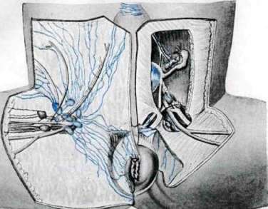 Femoral Canal: figure 7 from the 1928–1936 encyclopedia article