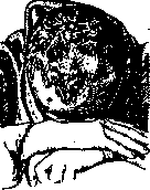 Alopecia: figure 2 from the 1928–1936 encyclopedia article