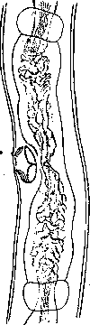 Trichosporia: figure 2 from the 1928–1936 encyclopedia article