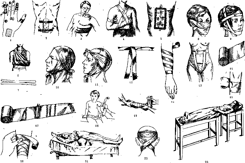Injuries: figure 1 from the 1928–1936 encyclopedia article