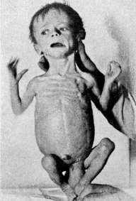 Wolff: figure 4 from the 1928–1936 encyclopedia article