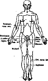 Anesthesia: figure 2 from the 1928–1936 encyclopedia article