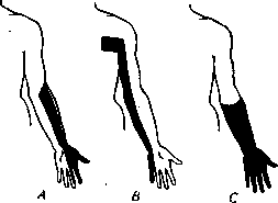 Anesthesia: figure 4 from the 1928–1936 encyclopedia article