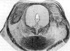 Trichophytia: figure 2 from the 1928–1936 encyclopedia article