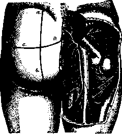 Local Anesthesia: figure 3 from the 1928–1936 encyclopedia article