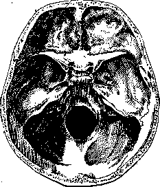 Sphenoid Bone: figure 1 from the 1928–1936 encyclopedia article