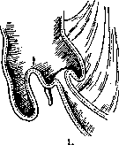 Intussusception (a1159): figure 1 from the 1928–1936 encyclopedia article