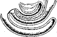 Intussusception (a1159): figure 5 from the 1928–1936 encyclopedia article